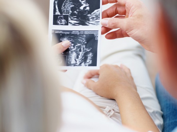 Closeup of a couple with their baby's sonogram picture